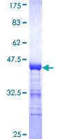 MAGED2 Protein - 12.5% SDS-PAGE Stained with Coomassie Blue.
