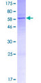 MAGED4 Protein - 12.5% SDS-PAGE of human MAGED4B stained with Coomassie Blue