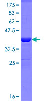 MAGI2 / AIP-1 Protein - 12.5% SDS-PAGE Stained with Coomassie Blue.