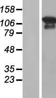 MAGI3 Protein - Western validation with an anti-DDK antibody * L: Control HEK293 lysate R: Over-expression lysate
