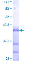 MAGI3 Protein - 12.5% SDS-PAGE Stained with Coomassie Blue.