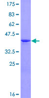 MAGOH Protein - 12.5% SDS-PAGE of human MAGOH stained with Coomassie Blue