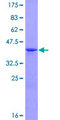 MAGOH Protein - 12.5% SDS-PAGE of human MAGOH stained with Coomassie Blue
