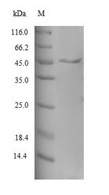 MAGOH Protein - (Tris-Glycine gel) Discontinuous SDS-PAGE (reduced) with 5% enrichment gel and 15% separation gel.