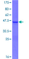 MAGOHB / Mago Protein - 12.5% SDS-PAGE of human FLJ10292 stained with Coomassie Blue