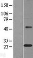 MAGP / MFAP2 Protein - Western validation with an anti-DDK antibody * L: Control HEK293 lysate R: Over-expression lysate