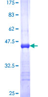 MAGP / MFAP2 Protein - 12.5% SDS-PAGE Stained with Coomassie Blue.