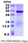 MAGP / MFAP2 Protein