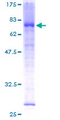 MAK Protein - 12.5% SDS-PAGE of human MAK stained with Coomassie Blue