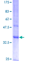 MAL Protein - 12.5% SDS-PAGE of human MAL stained with Coomassie Blue
