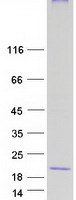 MAL Protein - Purified recombinant protein MAL was analyzed by SDS-PAGE gel and Coomassie Blue Staining