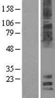 MAL2 Protein - Western validation with an anti-DDK antibody * L: Control HEK293 lysate R: Over-expression lysate