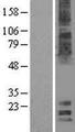 MAL2 Protein - Western validation with an anti-DDK antibody * L: Control HEK293 lysate R: Over-expression lysate