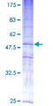 MAL2 Protein - 12.5% SDS-PAGE of human MAL2 stained with Coomassie Blue