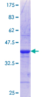 MALIN / NHLRC1 Protein - 12.5% SDS-PAGE Stained with Coomassie Blue.