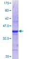MALIN / NHLRC1 Protein - 12.5% SDS-PAGE Stained with Coomassie Blue.