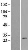 MALSU1 Protein - Western validation with an anti-DDK antibody * L: Control HEK293 lysate R: Over-expression lysate