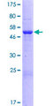 MALSU1 Protein - 12.5% SDS-PAGE of human C7orf30 stained with Coomassie Blue