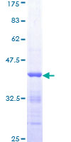 MALT1 Protein - 12.5% SDS-PAGE Stained with Coomassie Blue.