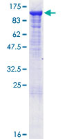 MALT1 Protein - 12.5% SDS-PAGE of human MALT1 stained with Coomassie Blue