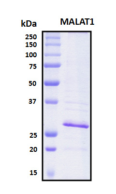 MALT1 Protein - SDS-PAGE under reducing conditions and visualized by Coomassie blue staining