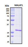 MALT1 Protein - SDS-PAGE under reducing conditions and visualized by Coomassie blue staining