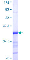 MAMLD1 Protein - 12.5% SDS-PAGE Stained with Coomassie Blue.