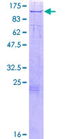 MAN2B1 / LAMAN Protein - 12.5% SDS-PAGE of human MAN2B1 stained with Coomassie Blue