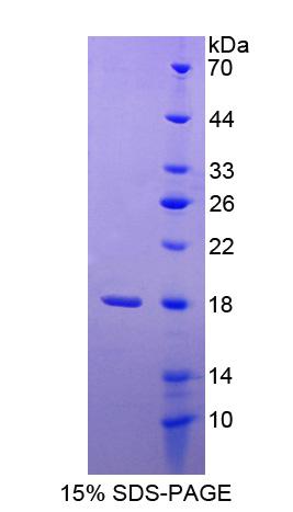 MAN2B1 / LAMAN Protein - Recombinant Mannosidase Alpha Class 2B Member 1 By SDS-PAGE