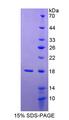 MAN2B1 / LAMAN Protein - Recombinant Mannosidase Alpha Class 2B Member 1 By SDS-PAGE