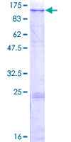 MAN2B2 Protein - 12.5% SDS-PAGE of human MAN2B2 stained with Coomassie Blue
