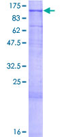 MAN2C1 Protein - 12.5% SDS-PAGE of human MAN2C1 stained with Coomassie Blue