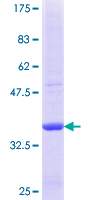 MAN2C1 Protein - 12.5% SDS-PAGE Stained with Coomassie Blue.