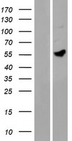 MANEAL Protein - Western validation with an anti-DDK antibody * L: Control HEK293 lysate R: Over-expression lysate