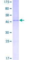 MANF / ARMET Protein - 12.5% SDS-PAGE of human ARMET stained with Coomassie Blue