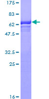 Mannose Phosphate Isomerase Protein - 12.5% SDS-PAGE of human MPI stained with Coomassie Blue