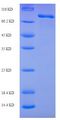 Mannose Receptor / CD206 Protein