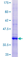 MAP17 / PDZK1IP1 Protein - 12.5% SDS-PAGE of human PDZK1IP1 stained with Coomassie Blue