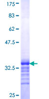 MAP17 / PDZK1IP1 Protein - 12.5% SDS-PAGE Stained with Coomassie Blue.