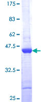 MAP1LC3A / LC3A Protein - 12.5% SDS-PAGE of human MAP1LC3A stained with Coomassie Blue