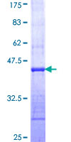 MAP1LC3A / LC3A Protein - 12.5% SDS-PAGE Stained with Coomassie Blue.