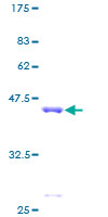 MAP1LC3B / LC3B Protein - 12.5% SDS-PAGE of human MAP1LC3B stained with Coomassie Blue
