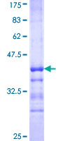 MAP1LC3B / LC3B Protein - 12.5% SDS-PAGE Stained with Coomassie Blue.