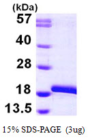 MAP1LC3B / LC3B Protein