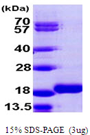 MAP1LC3B2 Protein