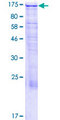 MAP1S Protein - 12.5% SDS-PAGE of human MAP1S stained with Coomassie Blue