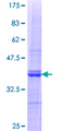 MAP1S Protein - 12.5% SDS-PAGE Stained with Coomassie Blue.