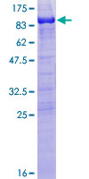 MAP2 Protein - 12.5% SDS-PAGE of human MAP2 stained with Coomassie Blue