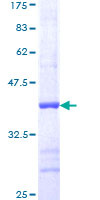 MAP2K1 / MKK1 / MEK1 Protein - 12.5% SDS-PAGE Stained with Coomassie Blue.