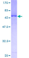 MAP2K3 / MEK3 / MKK3 Protein - 12.5% SDS-PAGE of human MAP2K3 stained with Coomassie Blue